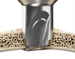 Disposable Cranial Perforators - EMD